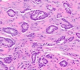 乳腺癌基因表达PCR芯片